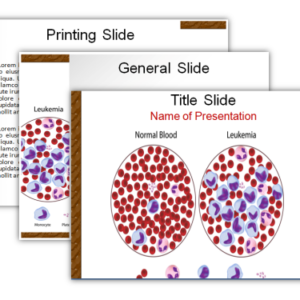 Leukemia Blood Cells PowerPoint Template 3 Slides