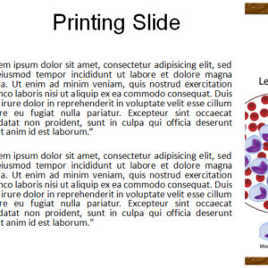 Leukemia Blood Cells PowerPoint Template Slide 3